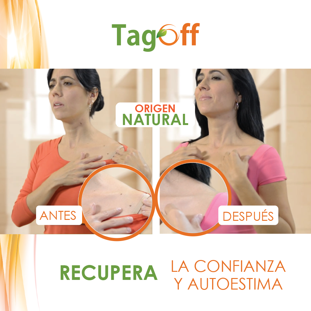 ✨ TagOff – Solución Natural para Eliminar Verrugas y Carnosidades