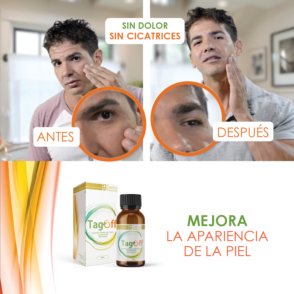 ✨ TagOff – Solución Natural para Eliminar Verrugas y Carnosidades