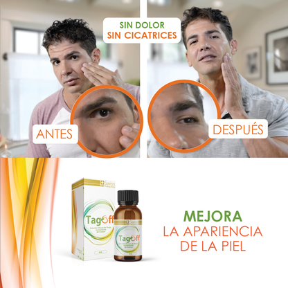 ✨ TagOff – Solución Natural para Eliminar Verrugas y Carnosidades
